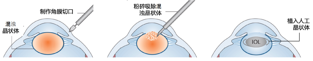 图片 4.png